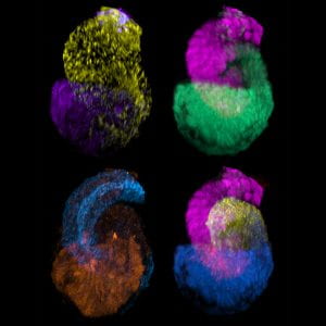 By superimposing images of several of the kidney’s filtering units, known as nephrons, researchers can visualize how little these structures deviate from a stereotypical developmental trajectory.  (Image by Nils Lindstrom/McMahon Lab/USC Stem Cell)